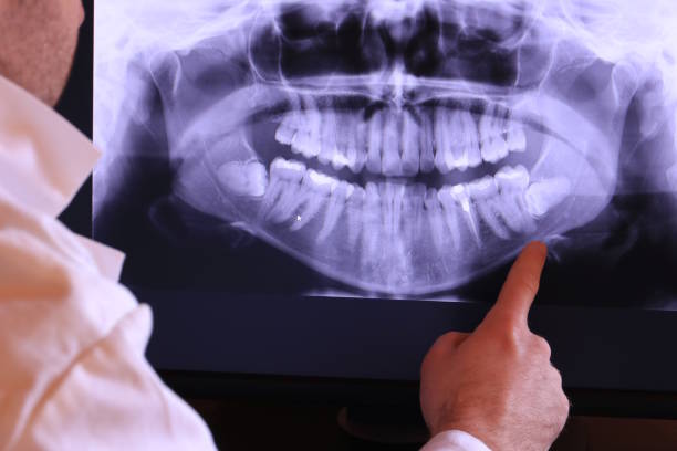 Best Emergency Dental Care for Broken or Chipped Teeth in Glenmora, LA