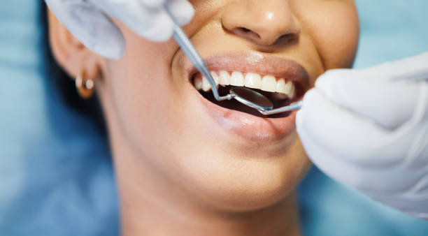 Best Emergency Treatment for Dental Infections or Abscesses in Glenmora, LA