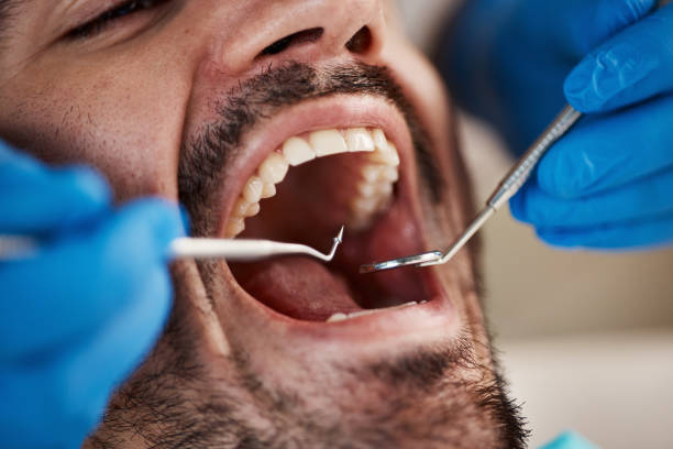 Fast & Reliable Emergency Dental Services in LA