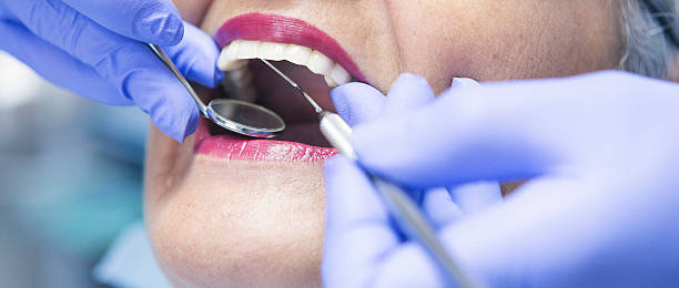 Best Emergency Dental Care for Broken or Chipped Teeth in Glenmora, LA